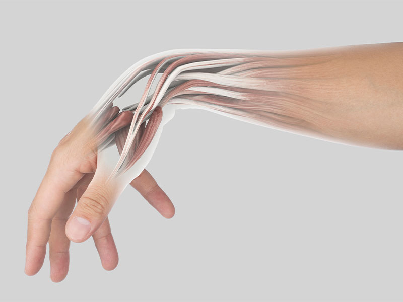 Warum Handgelenke trainieren? Handgelenk-Muskeln, Handgelenke aufwärmen, Handgelenk-Übungen, Handgelenke beim Krafttraining, Handgelenk-Schmerzen & FAQ.